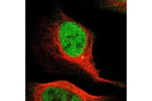 Immunofluorescent staining of U-2 OS with MCM3 polyclonal antibody  (Green) shows positivity in centrosome and nucleus but excluded from the nucleoli. (MCM3 抗体)