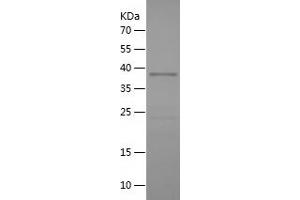 TACC3 Protein (AA 390-689) (His tag)