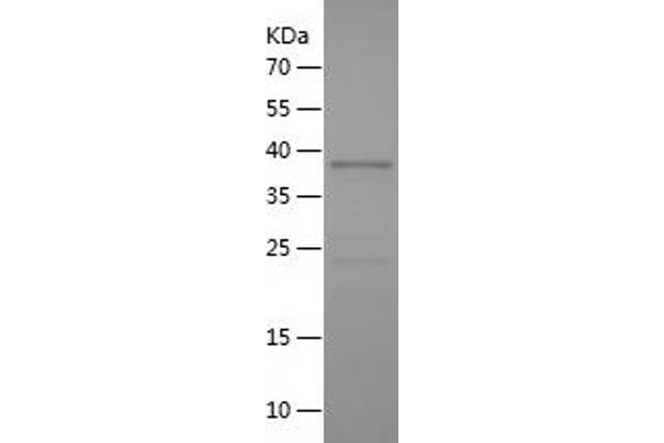 TACC3 Protein (AA 390-689) (His tag)