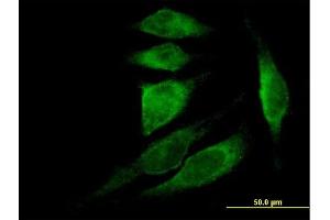 Immunofluorescence of purified MaxPab antibody to TMSB4X on HeLa cell. (TMSB4X 抗体  (AA 1-44))