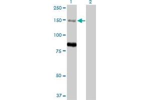 Western Blot analysis of MTMR3 expression in transfected 293T cell line by MTMR3 monoclonal antibody (M07A), clone 1E11. (MTMR3 抗体  (AA 579-674))