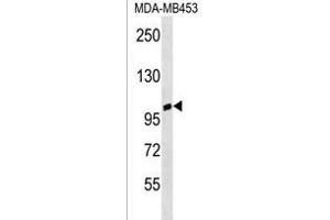 ANKRD20A3 Antibody (C-term) (ABIN1537600 and ABIN2850333) western blot analysis in MDA-M cell line lysates (35 μg/lane). (ANKRD20A3 抗体  (C-Term))