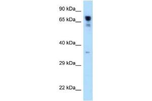 WB Suggested Anti-RARS Antibody Titration: 1. (RARS 抗体  (C-Term))