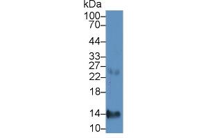 Detection of CXCL7 in Human Liver lysate using Monoclonal Antibody to Chemokine (C-X-C motif) ligand 7 ( CXCL7) (CXCL7 抗体  (AA 59-128))