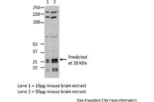 Sample Type: Lane1 = 10ug mouse brain extractLane 2 = 50ug mouse brain extractPrimary Antibody Dilution: Anti-EIF4E 1:1000Submitted By: Dr. (EIF4E 抗体  (C-Term))