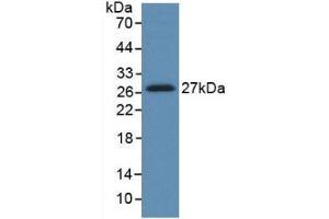 Detection of Recombinant HGF, Human using Monoclonal Antibody to Hepatocyte Growth Factor (HGF) (HGF 抗体  (AA 495-728))
