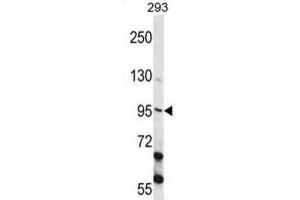 Western Blotting (WB) image for anti-Epithelial Cell Transforming Sequence 2 Oncogene (ECT2) antibody (ABIN2998212) (ECT2 抗体)