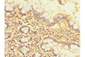 Immunohistochemistry of paraffin-embedded human small intestine tissue using ABIN7161966 at dilution of 1:100 (Nucleolar Protein 1 (NOL1) (AA 1-210) 抗体)