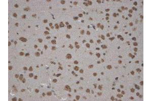 Zinedin Immunohistochemistry. (STRN4 抗体  (Internal Region))
