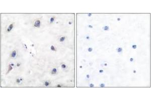 Immunohistochemistry analysis of paraffin-embedded human brain tissue, using DARPP-32 (Ab-34) Antibody. (DARPP32 抗体  (AA 18-67))