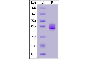 Human Siglec-15, His Tag on  under reducing (R) condition. (SIGLEC15 Protein (AA 20-263) (His tag))