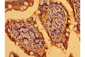 Immunohistochemistry of paraffin-embedded human small intestine tissue using ABIN7165166 at dilution of 1:100 (C19ORF12 抗体  (AA 65-104))