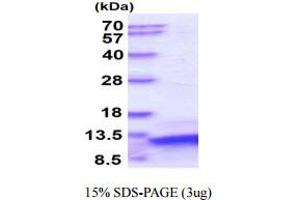 SDS-PAGE (SDS) image for Parathyroid Hormone (PTH) protein (ABIN666842) (PTH 蛋白)