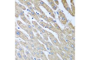 Immunohistochemistry of paraffin-embedded human liver using FUT6 antibody (ABIN5972052) at dilution of 1/100 (40x lens). (FUT6 抗体)