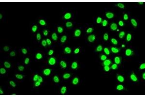 Immunofluorescence analysis of MCF-7 cells using REST Polyclonal Antibody (REST 抗体)