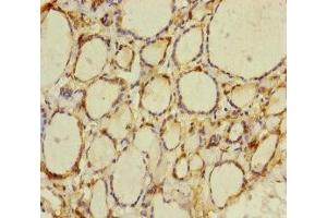 Immunohistochemistry of paraffin-embedded human thyroid tissue using ABIN7165198 at dilution of 1:100 (CRBN 抗体  (AA 1-280))