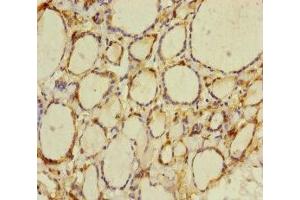 Immunohistochemistry of paraffin-embedded human thyroid tissue using ABIN7165198 at dilution of 1:100