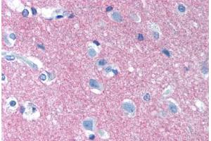 Human Brain, Cortex (formalin-fixed, paraffin-embedded) stained with NCAM1 antibody ABIN239830 at 10 µg/ml followed by biotinylated anti-mouse IgG secondary antibody ABIN481714, alkaline phosphatase-streptavidin and chromogen. (CD56 抗体)