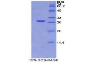 SDS-PAGE analysis of Mouse GSTm2 Protein. (GSTM2 蛋白)