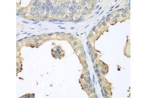 Immunohistochemistry of paraffin-embedded Human prostate using GPI Polyclonal Antibody at dilution of 1:100 (40x lens). (GPI 抗体)
