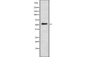 Western blot analysis IFI-56K using LOVO whole cell lysates (IFIT1 抗体  (Internal Region))