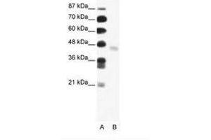 Image no. 1 for anti-FEZ Family Zinc Finger 2 (FEZF2) (N-Term) antibody (ABIN202569) (FEZF2 抗体  (N-Term))
