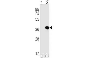 Western blot analysis of HLA-G antibody and 293 cell lysate either nontransfected (Lane 1) or transiently transfected (2) with the HLA-G gene. (HLAG 抗体  (AA 62-89))