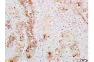 Formalin-fixed and paraffin embedded mouse thyroid labeled with Anti-Secretin receptor Polyclonal Antibody, Unconjugated (ABIN724730) at 1:200 followed by conjugation to the secondary antibody and DAB staining (SCTR 抗体  (AA 188-280))