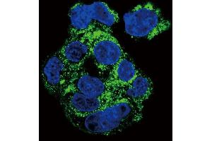 Confocal immunofluorescent analysis of CSF1R Antibody (ABIN652364 and ABIN2841700) with HepG2 cell followed by Alexa Fluor 488-conjugated goat anti-rabbit lgG (green). (CSF1R 抗体)