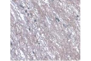Detection of LRG1 in Rat Spinal Cord Tissue using Monoclonal Antibody to Leucine Rich Alpha-2-Glycoprotein 1 (LRG1) (LRG1 抗体  (AA 154-332))