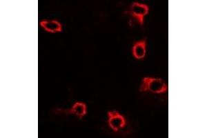 Immunofluorescence (IF) image for anti-Acid Phosphatase 5, Tartrate Resistant (ACP5) antibody (ABIN7307452)