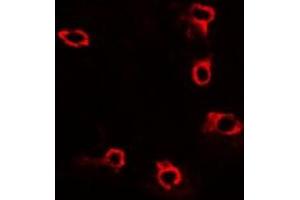 Immunofluorescent analysis of ACP5 staining in U2OS cells. (ACP5 抗体)