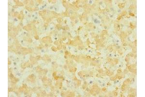 Immunohistochemistry of paraffin-embedded human liver tissue using ABIN7161009 at dilution of 1:100 (NOX3 抗体  (AA 223-395))