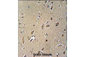 Image no. 1 for anti-Nerve Growth Factor Receptor (NGFR) antibody (ABIN2451580) (NGFR 抗体)