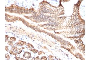Immunohistochemistry (IHC) image for anti-Tumor-Associated Calcium Signal Transducer 2 (TACSTD2) (AA 31-274) antibody (ABIN6939971)