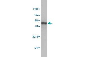 Western Blotting (WB) image for anti-MAD2 Mitotic Arrest Deficient-Like 1 (Yeast) (MAD2L1) (AA 1-205) antibody (ABIN561710)