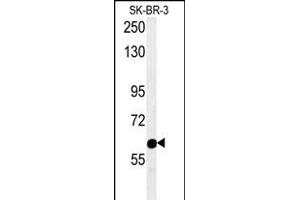 RADIL Antibody (C-term) (ABIN654195 and ABIN2844045) western blot analysis in SK-BR-3 cell line lysates (15 μg/lane). (Radil 抗体  (C-Term))
