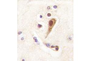 Image no. 1 for anti-LIM Homeobox 6 (LHX6) (N-Term) antibody (ABIN356903) (LHX6 抗体  (N-Term))