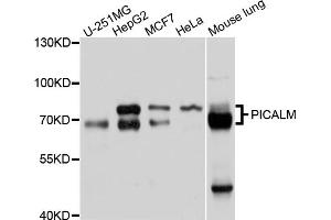Western blot analysis of extracts of various cell lines, using PICALM antibody (ABIN4904757) at 1:1000 dilution. (PICALM 抗体)