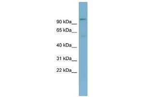 TBL3 antibody used at 1 ug/ml to detect target protein. (TBL3 抗体)