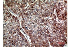 Immunohistochemistry (IHC) analysis of paraffin-embedded Human Lung, antibody was diluted at 1:100. (IL-24 抗体  (Internal Region))