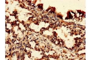IHC image of ABIN7149549 diluted at 1:150 and staining in paraffin-embedded human lung tissue performed on a Leica BondTM system. (DAP 抗体  (AA 2-102))
