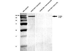 Western Blot analysis of Human HEK-T lysates showing detection of GluN2B/NR2B protein using Mouse Anti-GluN2B/NR2B Monoclonal Antibody, Clone S59-36 . (GRIN2B 抗体  (AA 20-271) (APC))