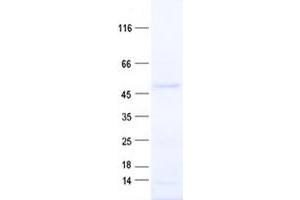 Western Blotting (WB) image for Ankyrin Repeat and BTB (POZ) Domain Containing 1 (ABTB1) protein (His tag) (ABIN2714294)