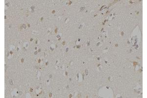 ABIN6276581 at 1/100 staining Human brain tissue by IHC-P. (NCF2 抗体  (N-Term))