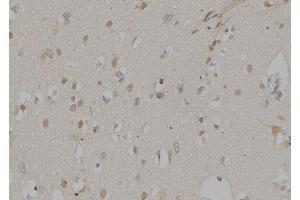 ABIN6276581 at 1/100 staining Human brain tissue by IHC-P.