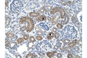 XTP3TPA antibody was used for immunohistochemistry at a concentration of 4-8 ug/ml to stain Epithelial cells of renal tubule (arrows) in Human Kidney. (DCTPP1 抗体  (Middle Region))