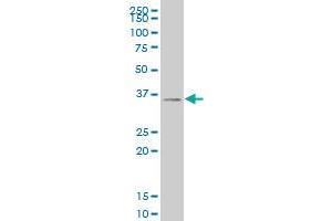SIX3 monoclonal antibody (M04), clone 1A2 Western Blot analysis of SIX3 expression in 293 . (SIX3 抗体  (AA 273-332))
