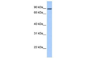 WB Suggested Anti-ZNF16 Antibody Titration:  0. (ZNF16 抗体  (N-Term))