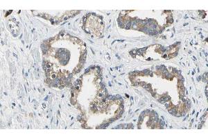 ABIN6268698 at 1/100 staining Human prostate tissue by IHC-P. (CD51 抗体  (Internal Region))